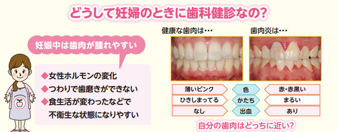江戸川区妊婦歯科健診　2023年　おだ歯科クリニック瑞江