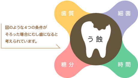 虫歯治療　4つの条件
