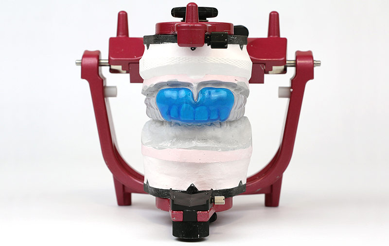 おだ歯科クリニックではカスタムメイドのスポーツ用マウスピースの作成も承っております。