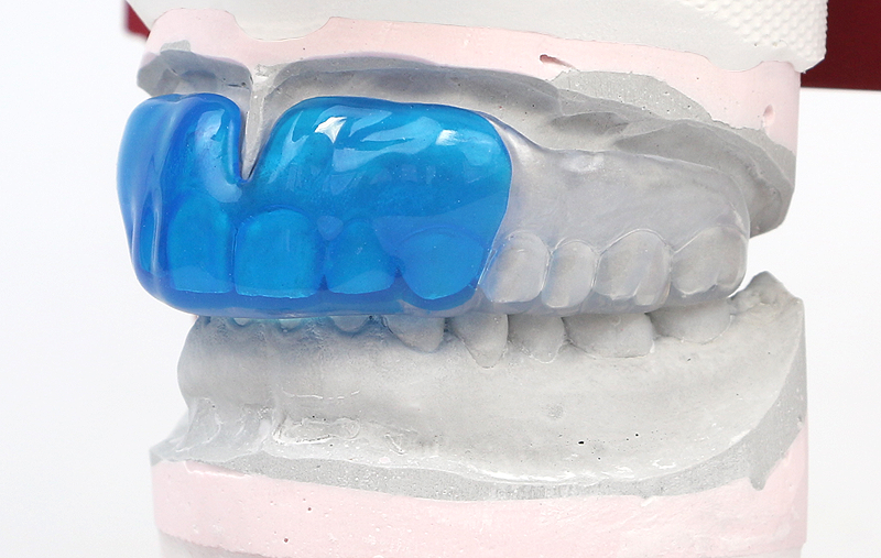 おだ歯科クリニックのカスタムメイドのスポーツ用マウスピースは歯型の印象を採取して作成するのでしっかりフィットしたマウスピースが出来上がります。