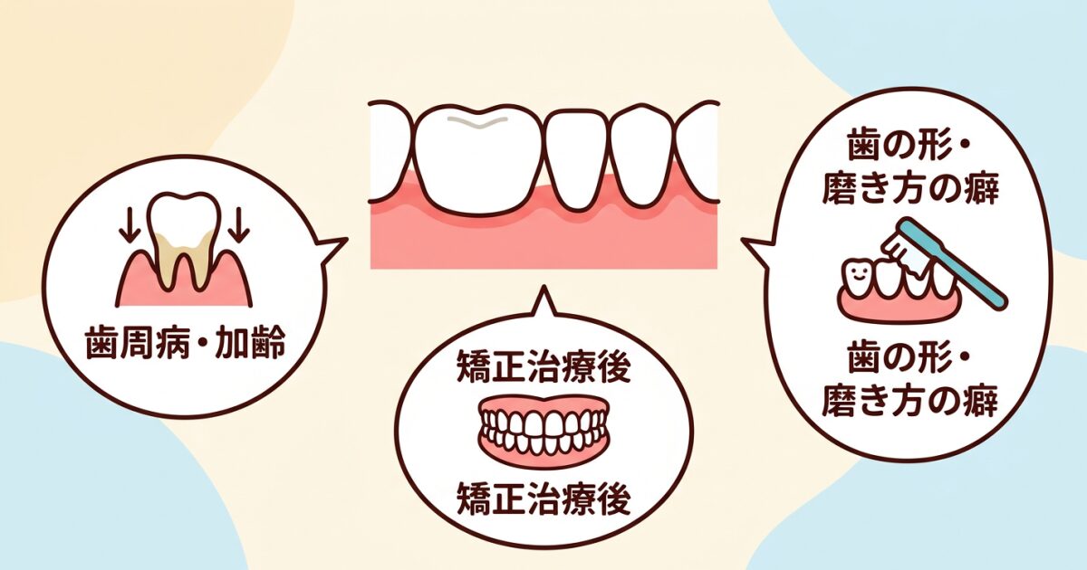 ■ブラックトライアングルが起こる原因は一つではない
