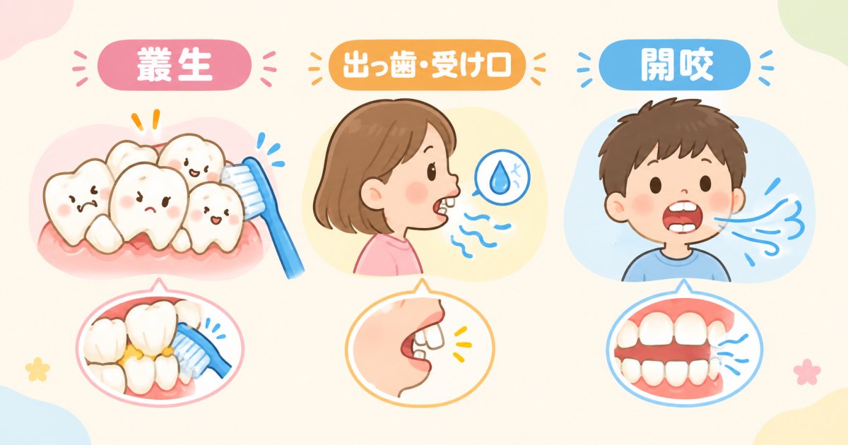 不正咬合の種類別に見る口臭のリスクと特徴
