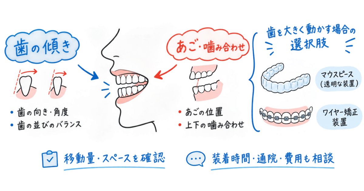 写真で出っ歯・受け口が気になる…マウスピース矯正とワイヤーの目安
